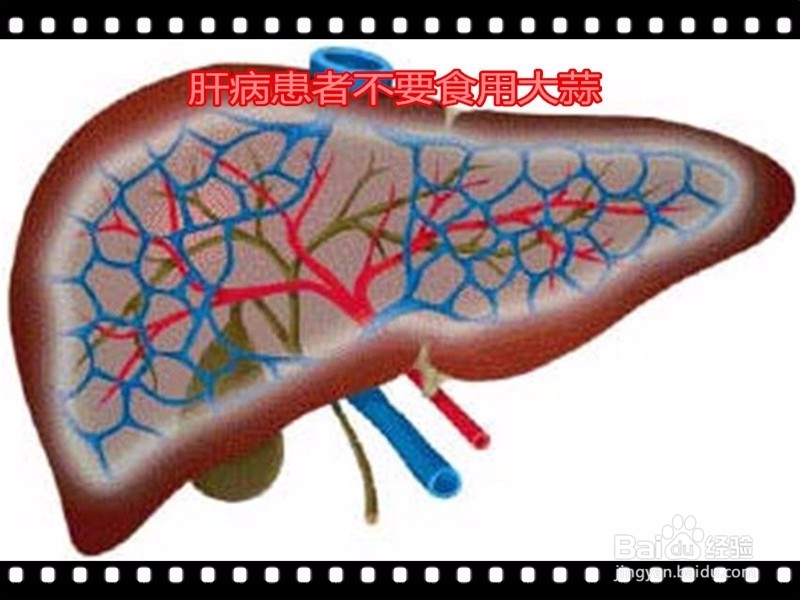 大蒜怎么吃才对身体有利,哪几类人群不能吃?
