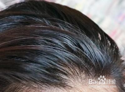 头发洗不干净黏糊糊的