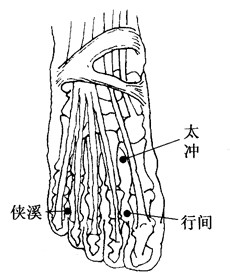 百病刮痧：[40]妊娠恶阻的刮痧疗法