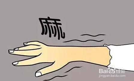 如何认知中风发作前的症状