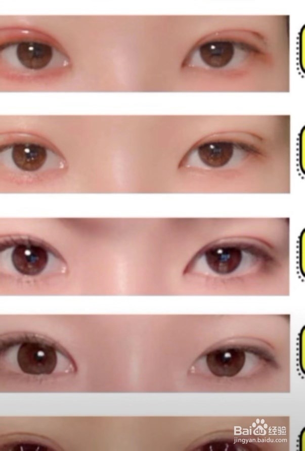 女生必知道的双眼皮术后注意事项