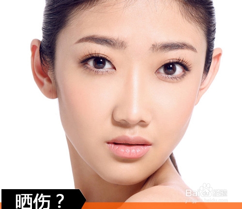 紫外线在作怪 做好防晒告别小雀斑