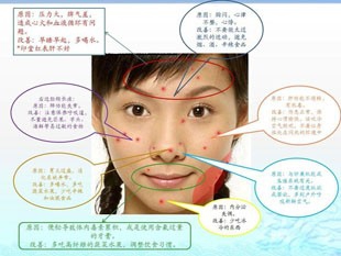 教你如何调理暗疮性皮肤