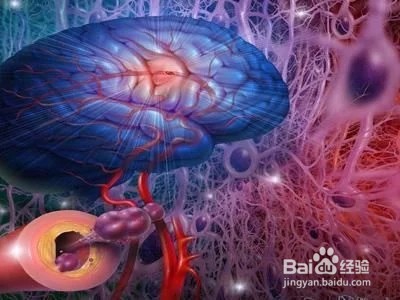 六个症状预示脑血栓或者脑出血