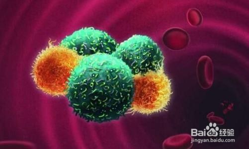 常见肿瘤转移途径汇总？金雀异黄素怎么样