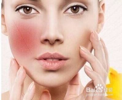 脸上红血丝怎么调理