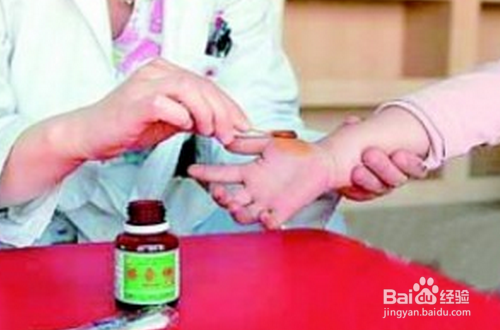 小孩伤口怎样预防疤痕?