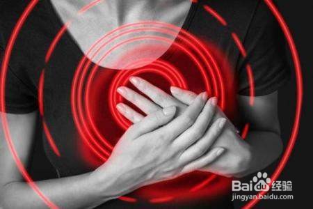 如何预防心源性猝死