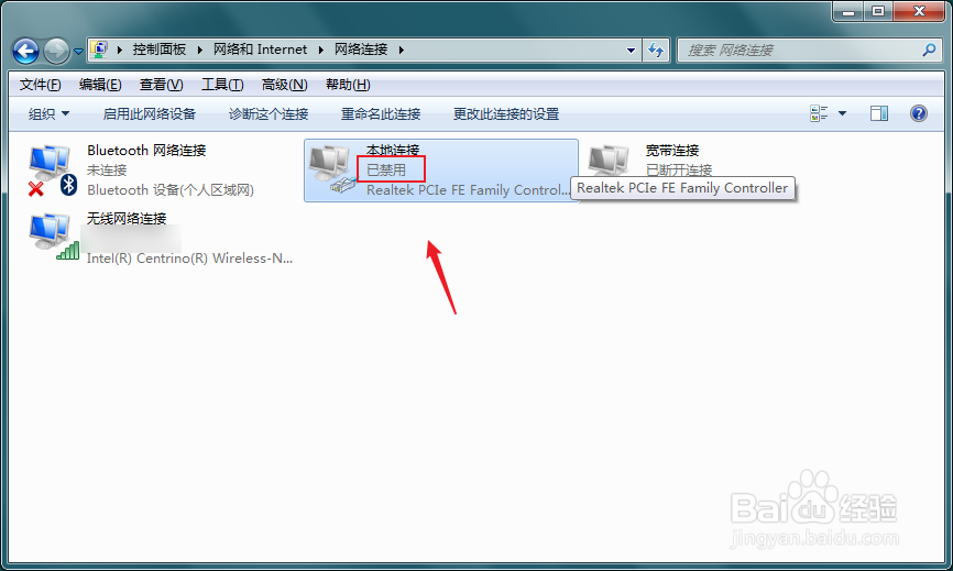禁用网络后如何恢复