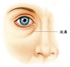 减肥之瘦肚子瘦腹——男女都适用