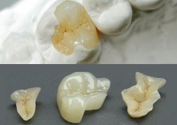 教你如何看牙齿才省钱