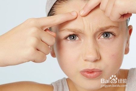 只留青春不留痘 额头痘痘大清理