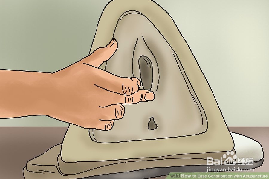 如何用针灸缓解便秘