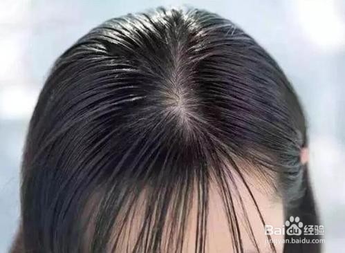 什么牌子的控油洗发水效果好