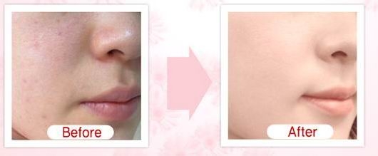 BB霜和CC霜的区别