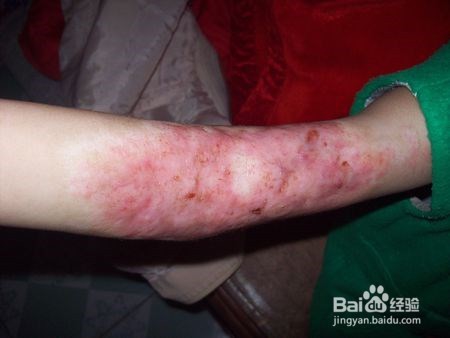 高温天气不要轻易触碰的东西