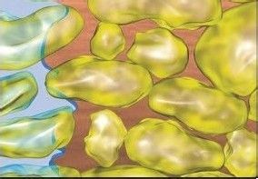 水动力吸脂对比图