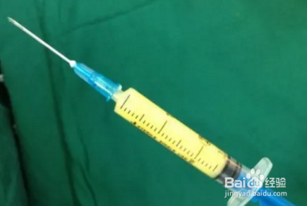 什么是填脂肪、自体脂肪填充大约需要多少钱？