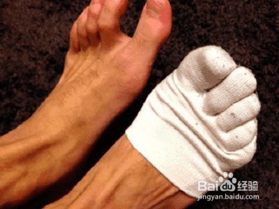 男人脚臭怎么办？男生脚臭用什么方法最好？