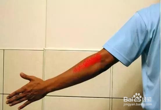 网球肘吃什么药最有效,网球肘康复锻炼方法