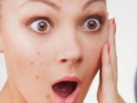 脸上长痘痘怎么调理