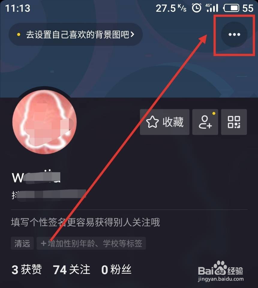 抖音下载的动态壁纸怎么删除