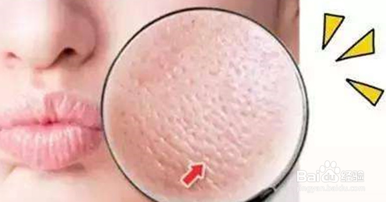 哪些坏习惯会导致毛孔越撑越大？