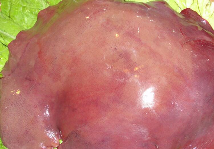 猪肝没炒熟能吃吗