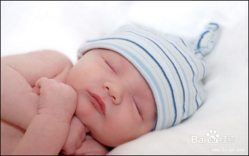 如何处理婴儿尿布疹