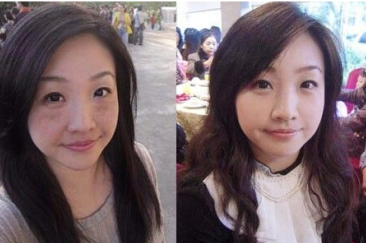 祛斑最好的方法