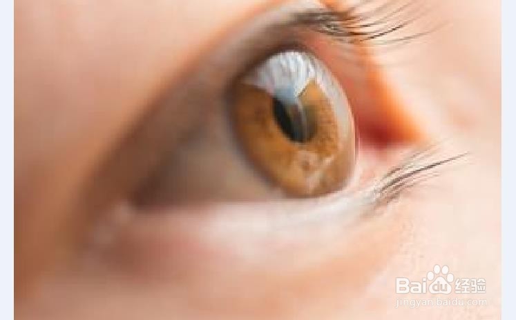 生活中怎样做好眼睛的保健