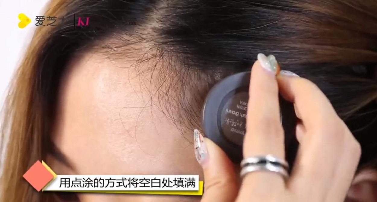 如何调整发际线