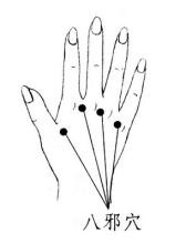 手上生泡疹有点疼怎么办