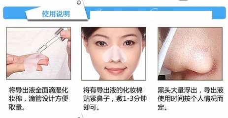 鼻子毛孔粗大有黑头怎么办?