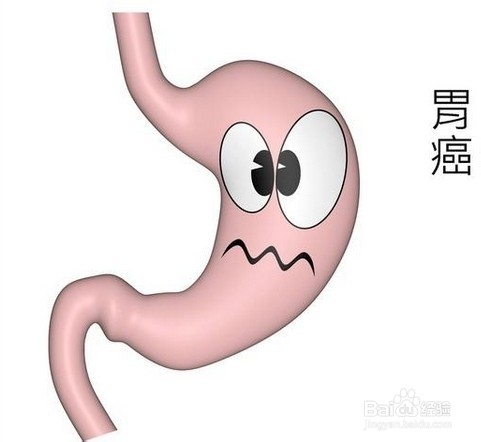 癌症是否会传染？癌症传染的有哪些？