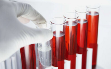 体检只需要做这些项目就够了