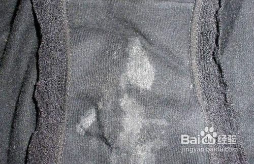 妇科疾病预防措施