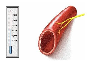 为什么自测血压有时候会不准？
