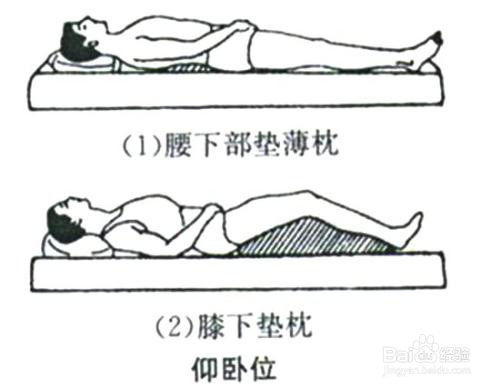 腰痛的运动缓解及腰椎间盘突出的预防