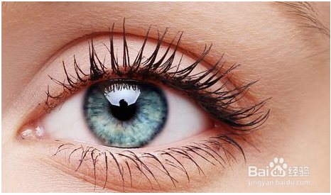 视神经萎缩康复病例