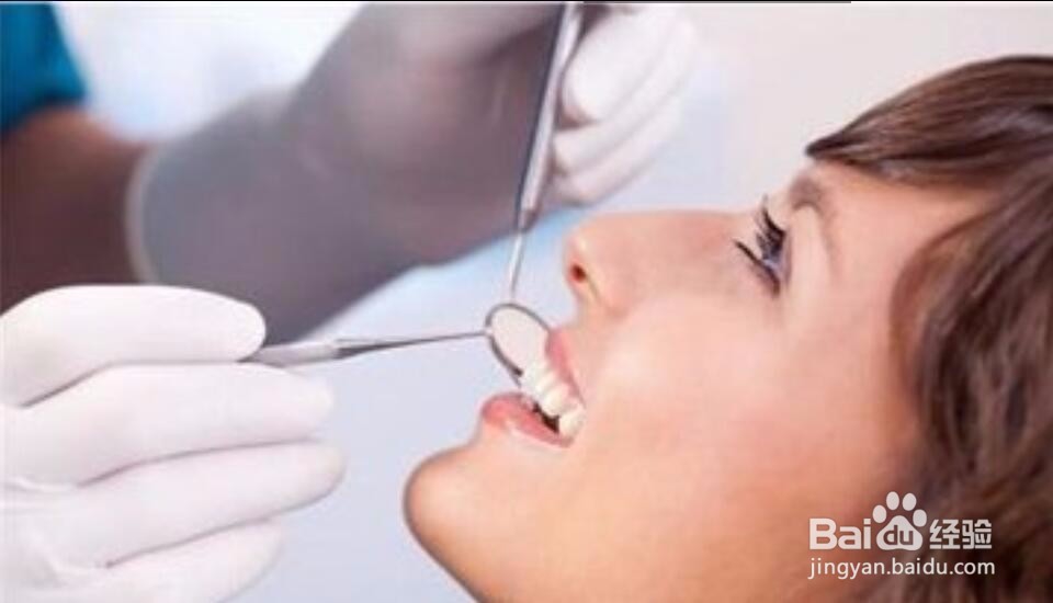 牙垢该如何清除？