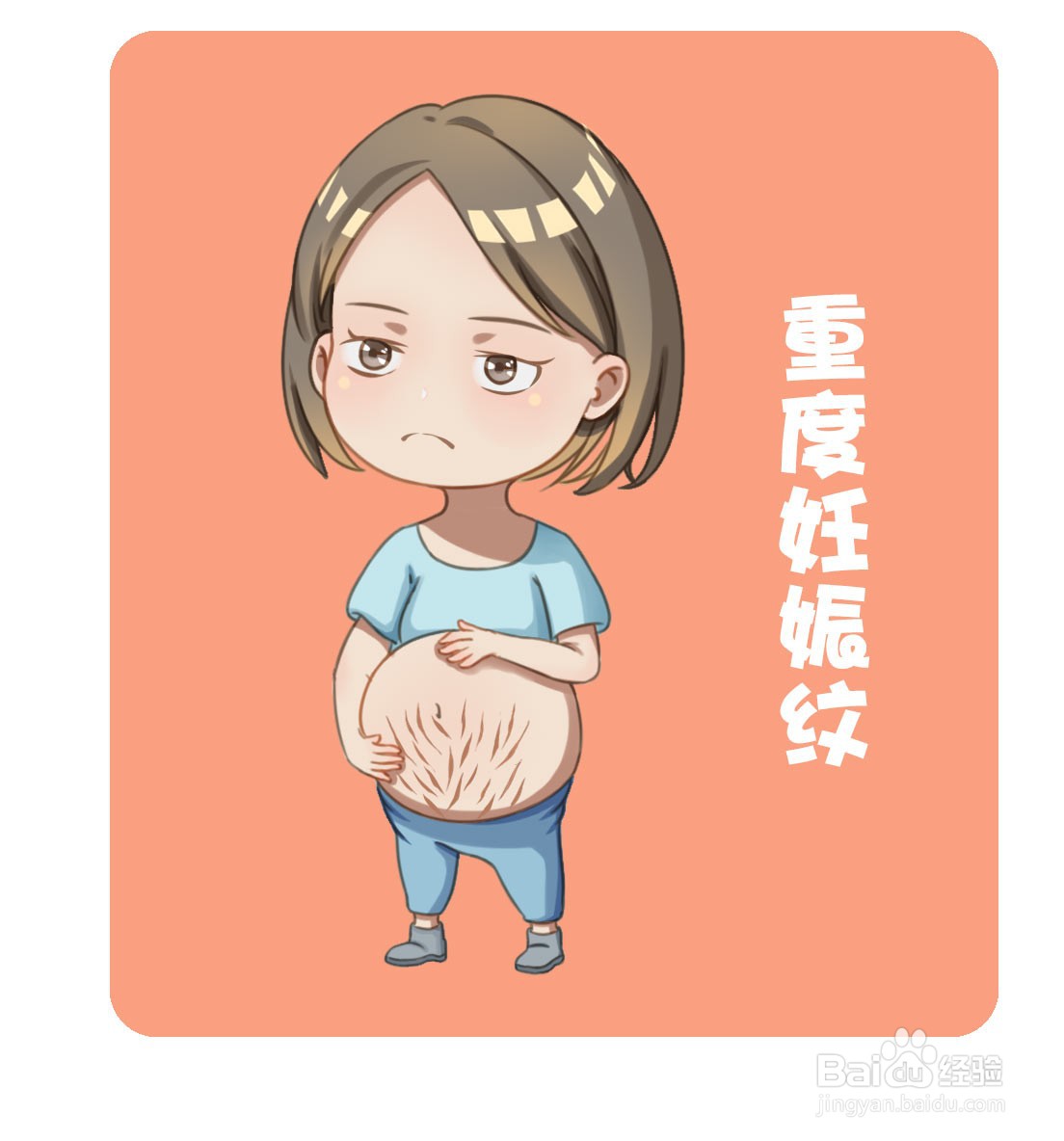 如何治疗妊娠纹