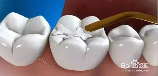 这些对待牙齿的习惯是错的你知道吗