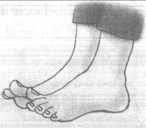 如何预防跑步时崴脚?