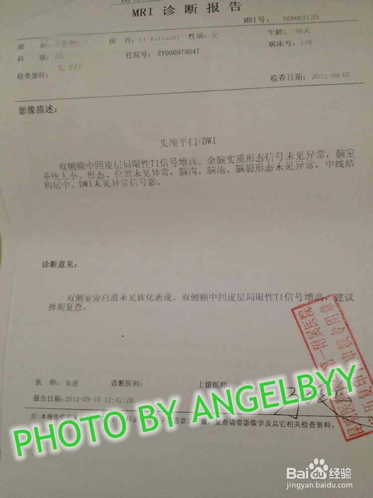 家有早产儿之颅脑出血