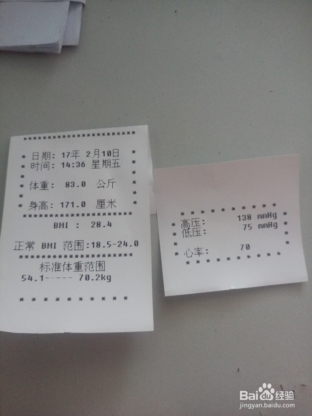 超声波体检机的测量方法步骤