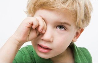 怎么预防眼疲劳、眼干涩