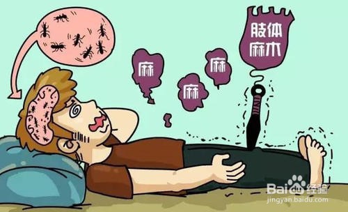 为什么蹲久了腿会麻？腿麻是怎么回事？