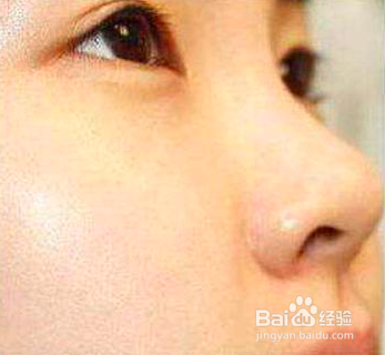 护理皮肤的正确流程