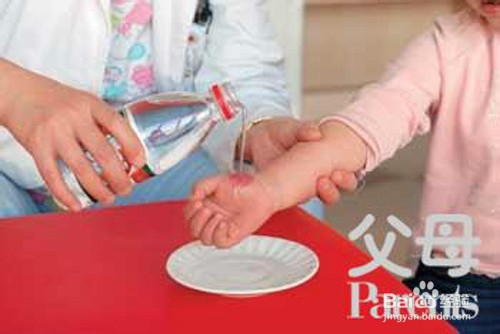 皮肤擦伤如何自行处理